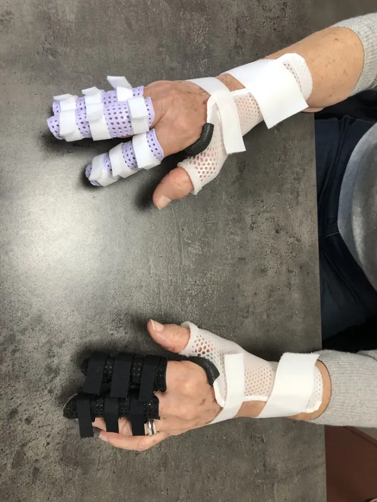 orthèse (11)webp